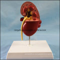 Modelo humano del riñón humano del PVC para la venta